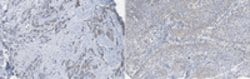 DNA Helicase B (HELB) Rabbit anti-Mouse, Polyclonal, MilliporeSigma 100